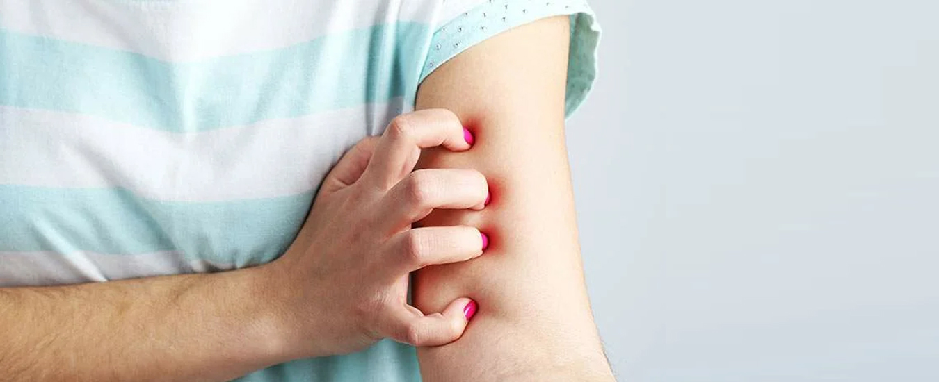 причины зуда причины зуда