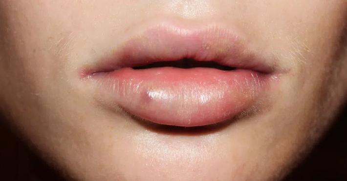 Мяч в губах