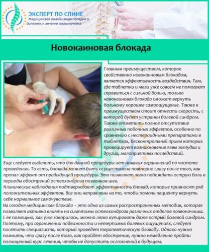 Новокаиновая блокада