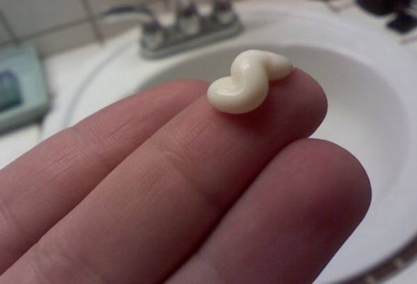 Анальный зуд при геморрое – решение проблемы