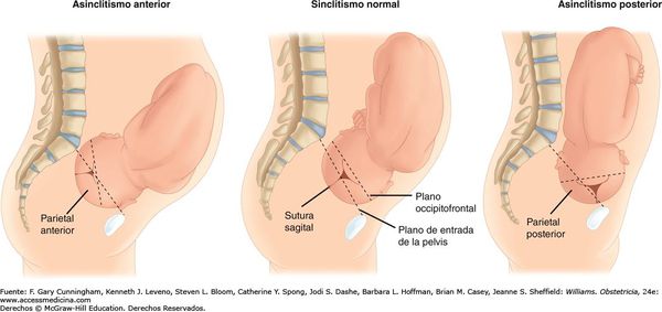 Передний и задний асинклитизм Передний и задний асинклитизм