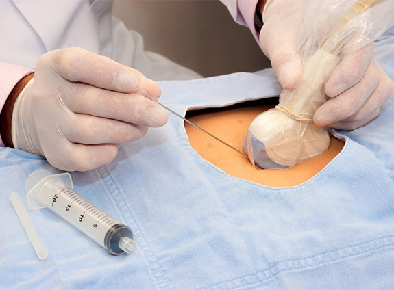 Биопсия кожи