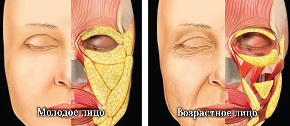 Как убрать тёмные круги под глазами