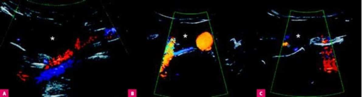 Ранние и поздние осложнения гинекологической хирургии: оценка в визуальных тестах
