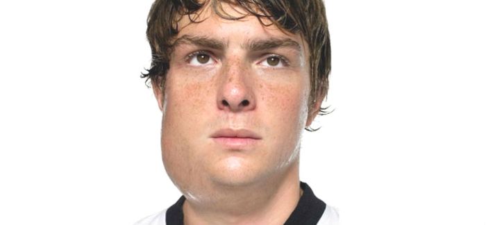 Отек лица - все причины и заболевания