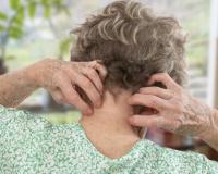 Старческий зуд