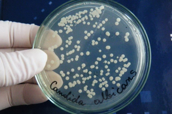 Посевной материал Candida albicans Посевной материал Candida albicans