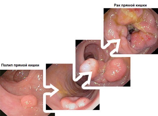 Зуд и жжение в ананальном отверстии у женщин и мужчин: причины и лечение