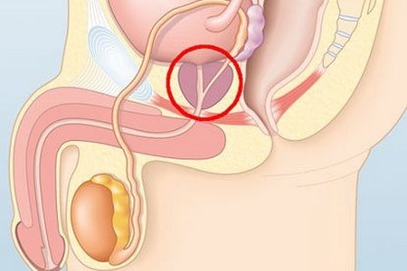 Предстательная железа Предстательная железа