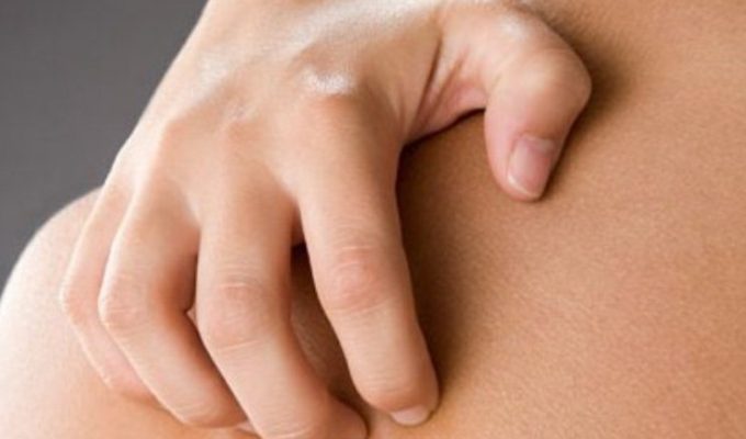 зуд_кожи_при_онкологии_5_03090151