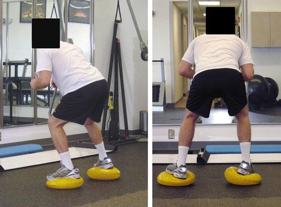 Лечение и операция при повреждении мениска