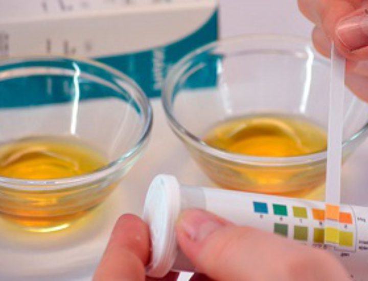 Ацетонемический синдром