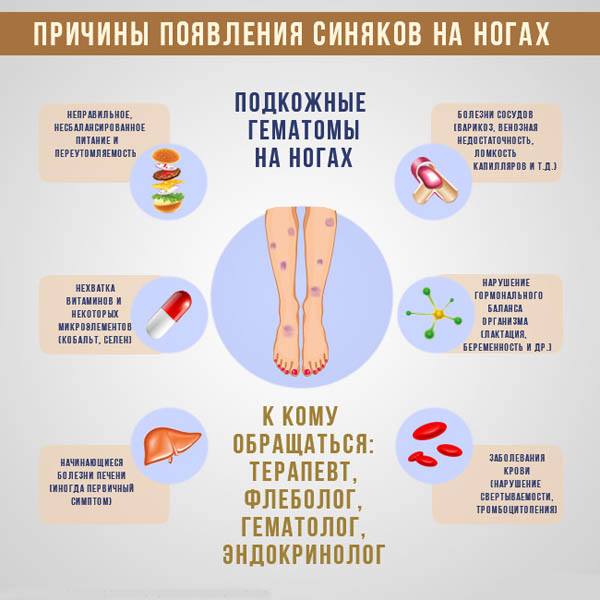Лопаются кровеносные сосуды и капилляры на ногах, появляются синяки: причины и лечение