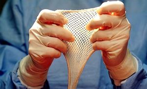 Пересадка кожи после ожога: как долго приживается, реабилитация, стоимость