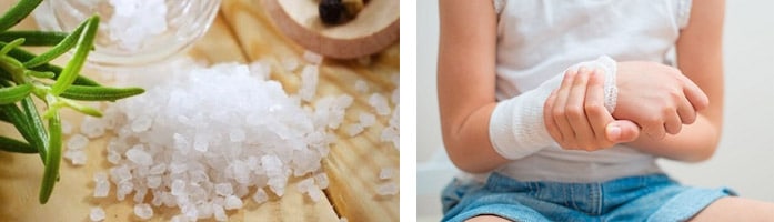 использование компрессов