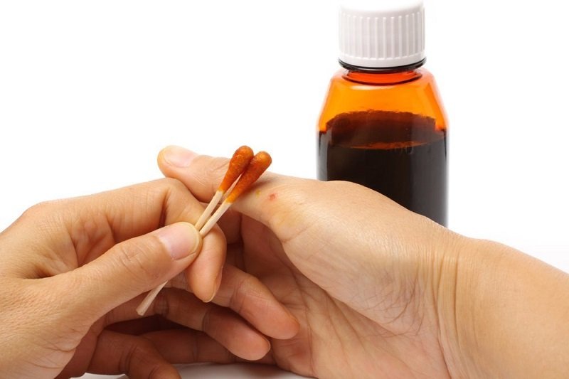 Как снизить излишнюю чувствительность головы в домашних условиях? При использовании йода будьте предельно осторожны, чтобы не обжечься.