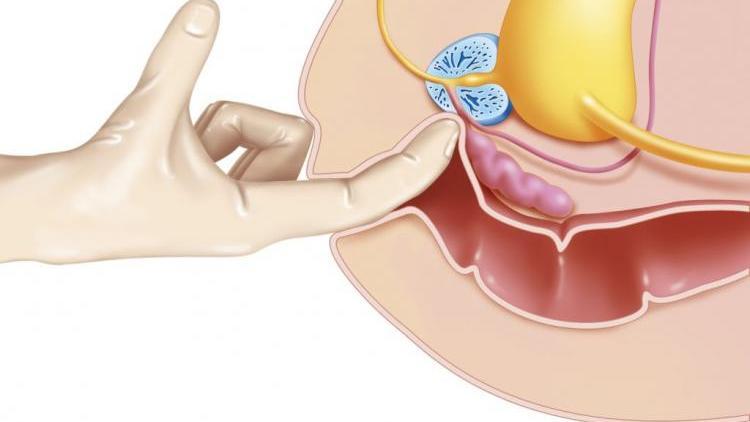 Массаж простаты пальцем мужу дома