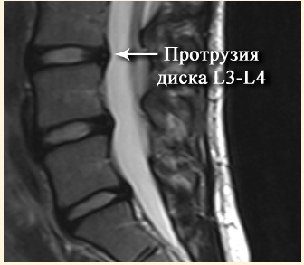 Аппликатор Кузнецова: как пользоваться и для чего, сколько лежать, инструкция