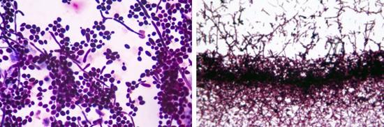 Дрожжеподобные грибы под микроскопом