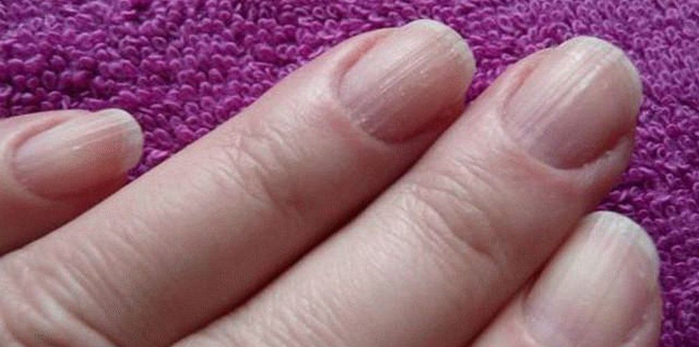 Продольные борозды