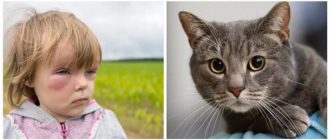 Анафилактическая реакция