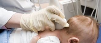 Отеки мозга у маленьких детей