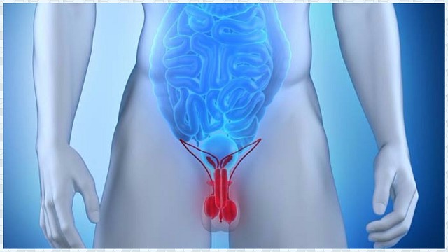 Варикоз яичка