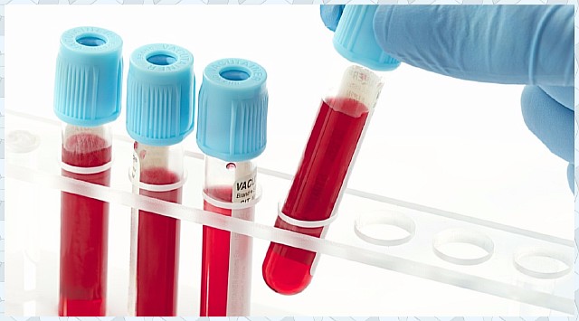 Симптомы и лечение кандидозного баланопостита