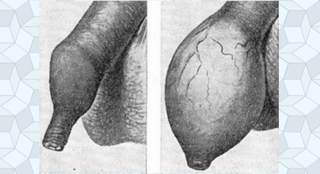 Что делать, если опухла головка и крайняя плоть