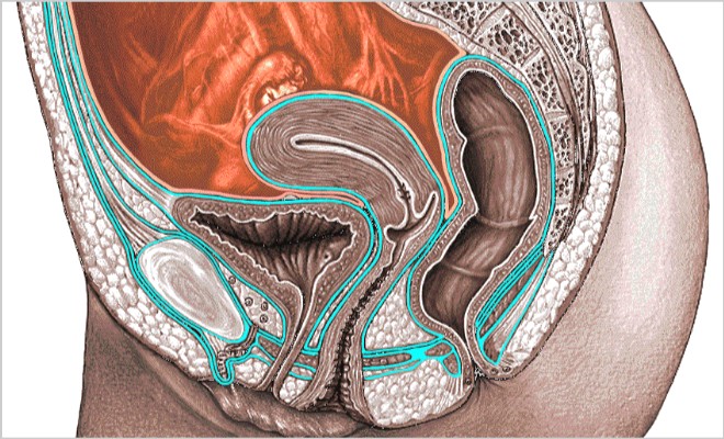 Что такое канцероматоз брюшной полости и как его лечить