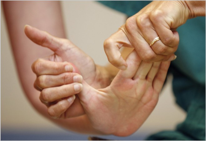 Отек головного мозга, как осложнение после инсульта