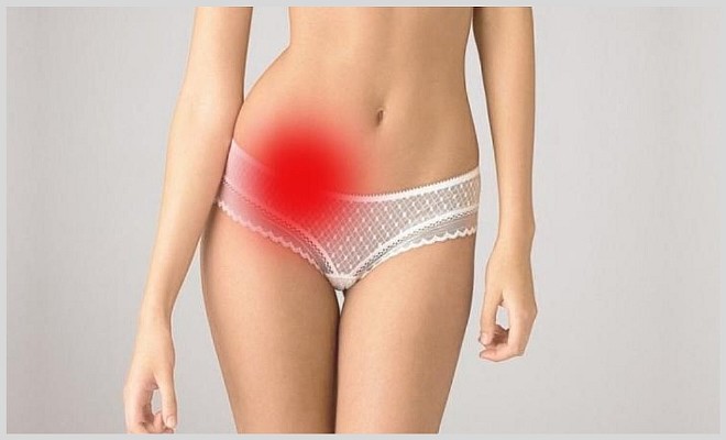 Лимфаденит в паху у женщин и мужчин: особенности лечения