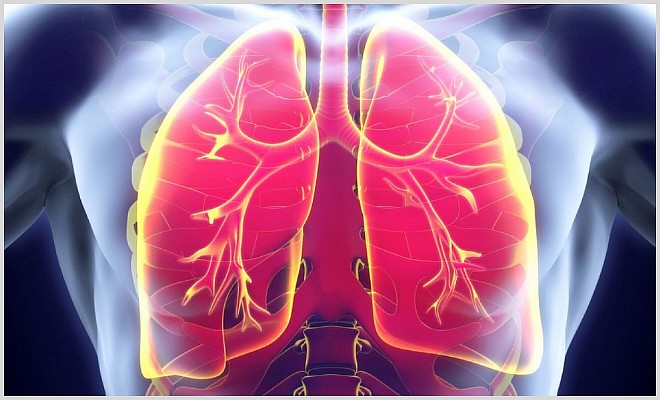 Отек легких и его международная классификация по коду мкб 10