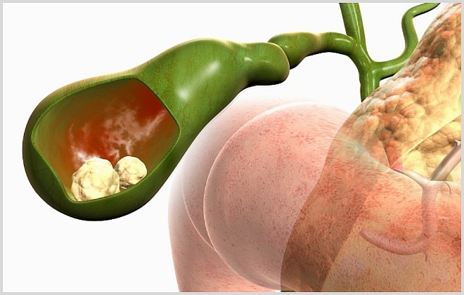 Список эффективных желчегонных таблеток