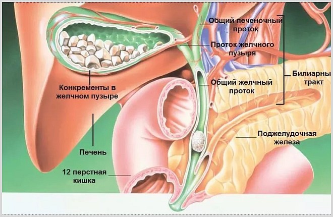 Застой желчи (холестаз): причины, симптомы и лечение
