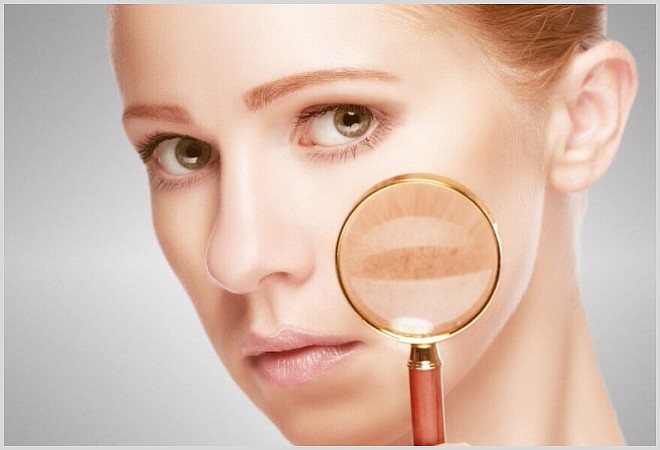 Застой желчи (холестаз): причины, симптомы и лечение