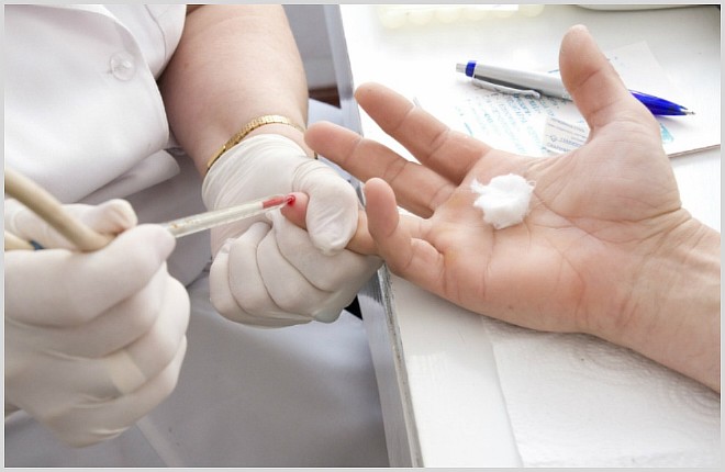 Застой желчи (холестаз): причины, симптомы и лечение