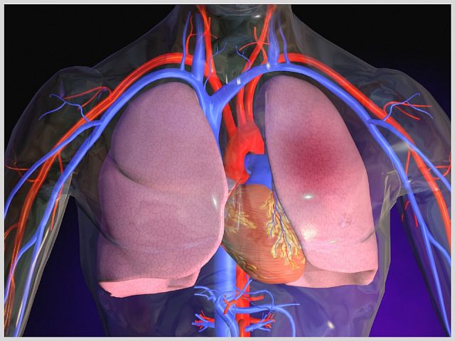 Почему возникает токсический отек