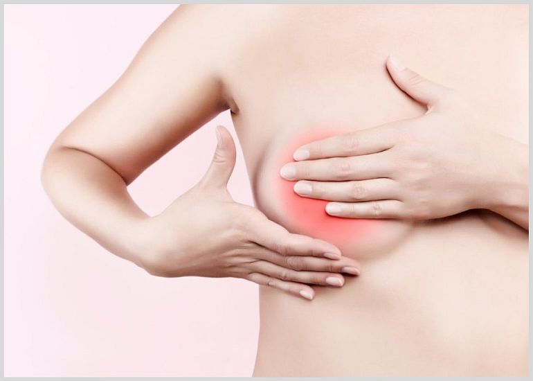 Как расцедить застой молока у женщины