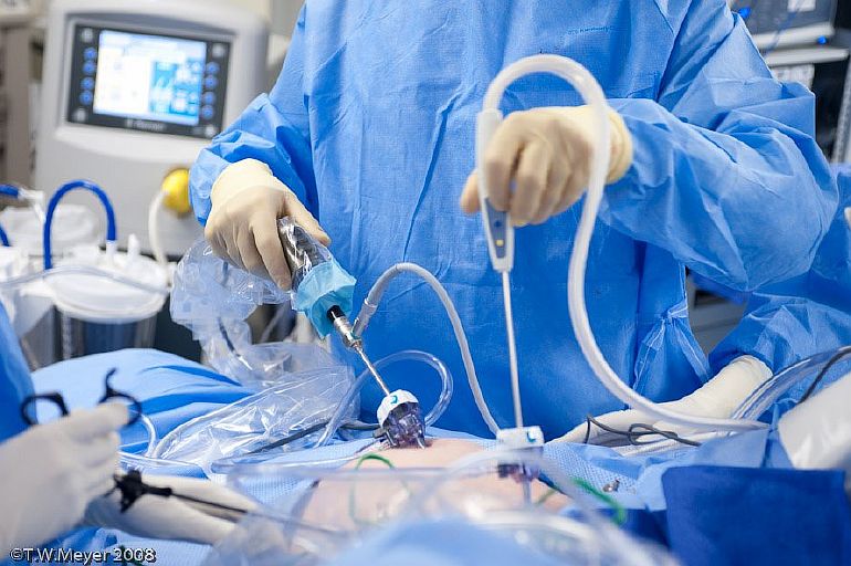 В каких случаях целесообразна лапароскопия при бесплодии?