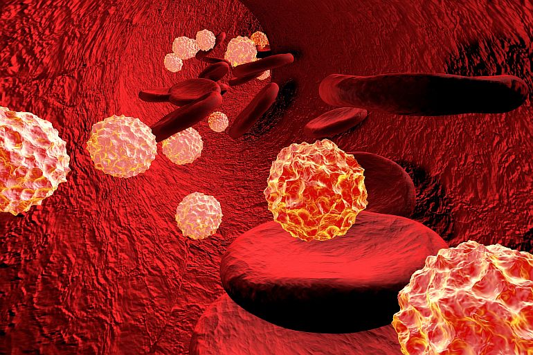 Что такое гепатит А