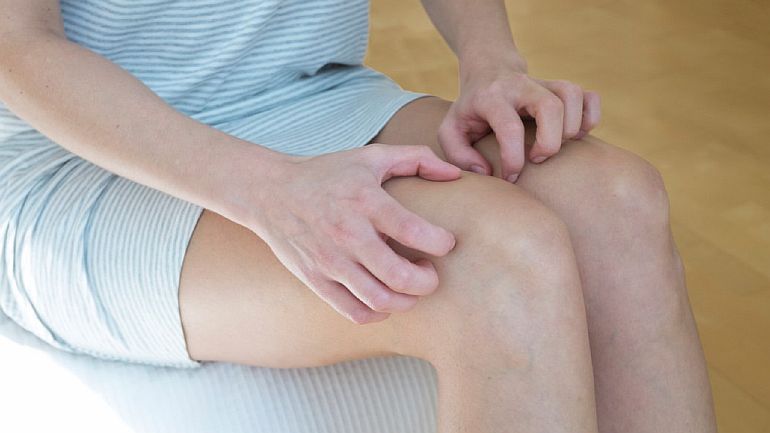 Опоясывающий лишай