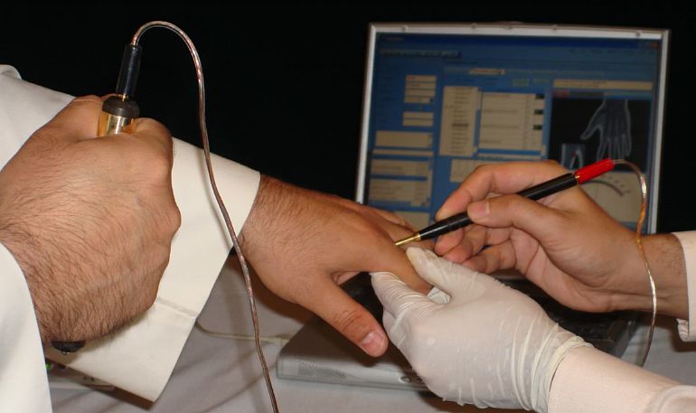 Электроакупунктура по Фоллю